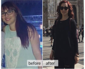 Prima e dopo perdita di peso — risultato 10