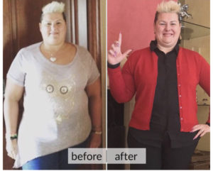 Prima e dopo perdita di peso — risultato 13