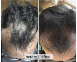 Prima e dopo capelli — risultato 1