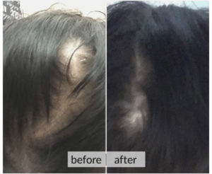 Prima e dopo capelli — risultato 2