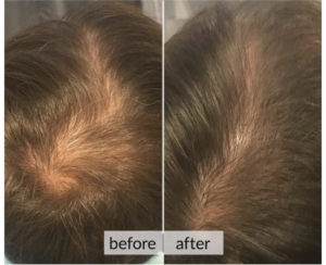 Prima e dopo capelli — risultato 3