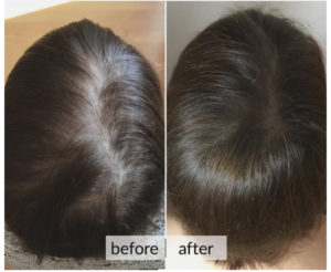 Prima e dopo capelli — risultato 4