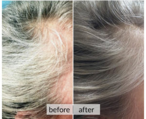 Prima e dopo capelli — risultato 5
