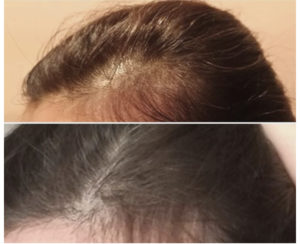 Prima e dopo capelli — risultato 7