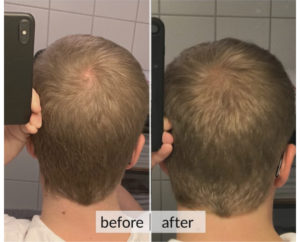 Prima e dopo capelli — risultato 8