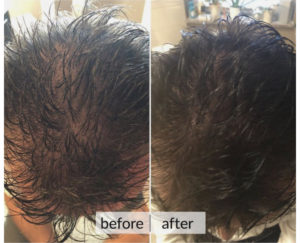 Prima e dopo capelli — risultato 9