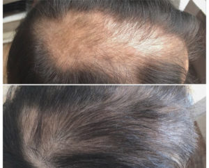 Prima e dopo capelli — risultato 10