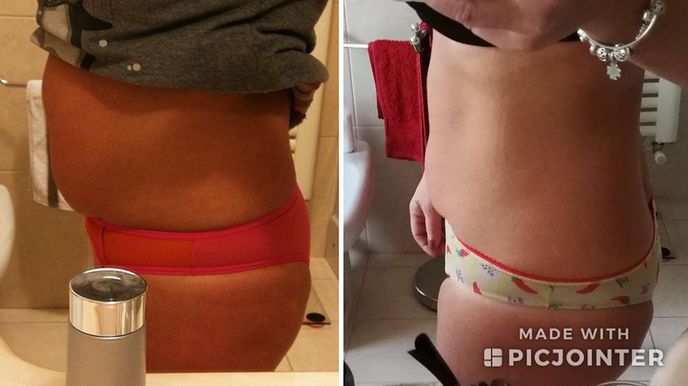 Risultato prima e dopo di Michela