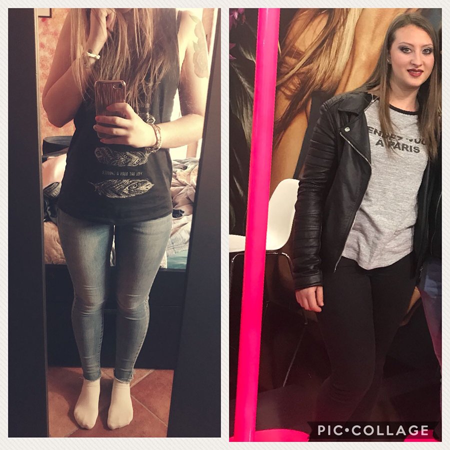 Risultato prima e dopo di Sara