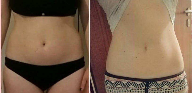 Risultato prima e dopo di Chiara