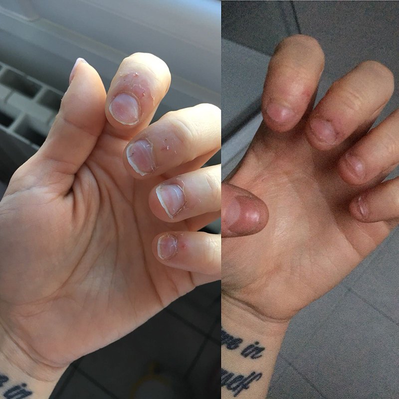 Risultato prima e dopo di Ylenia
