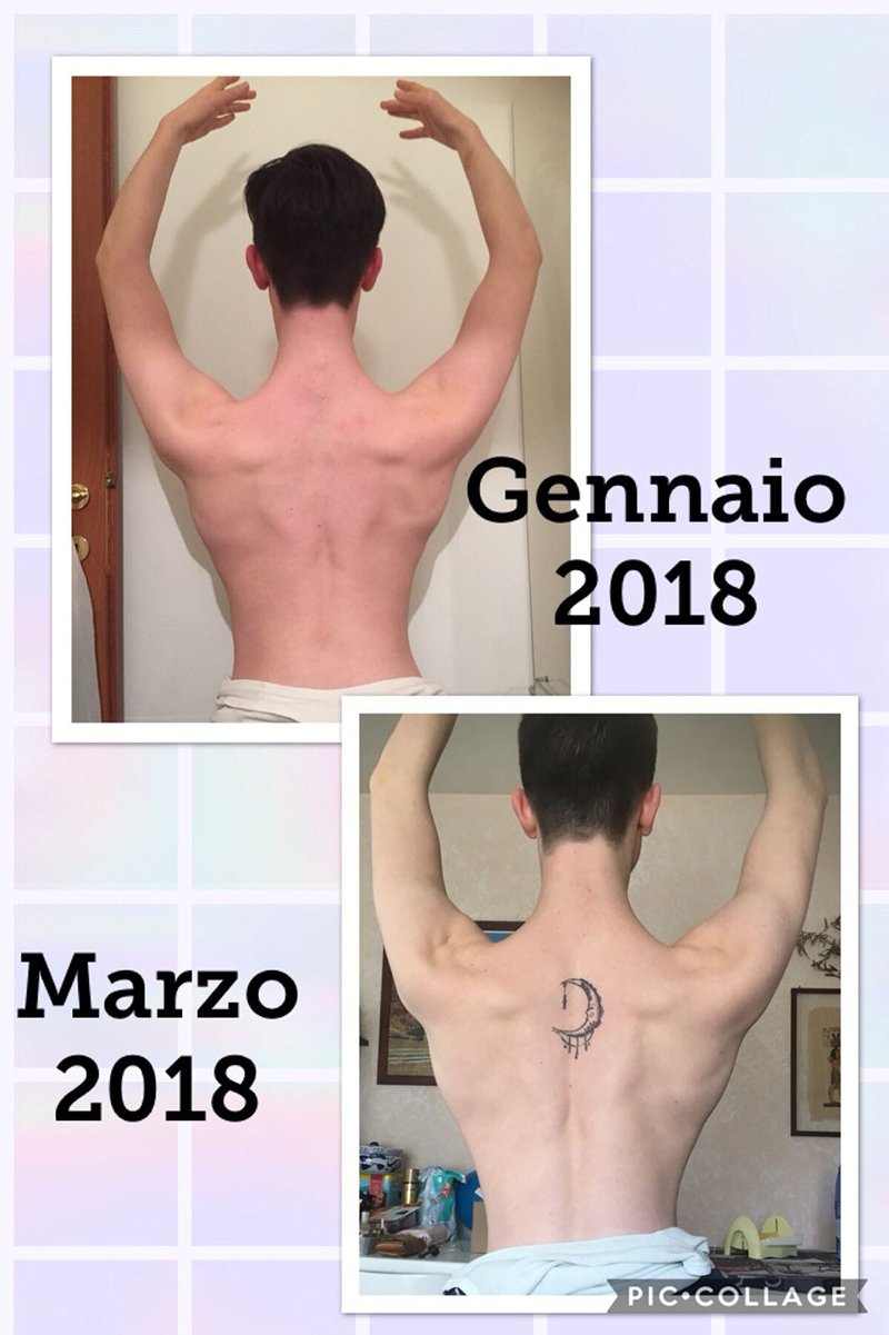 Risultato prima e dopo di Mamma di un ballerino