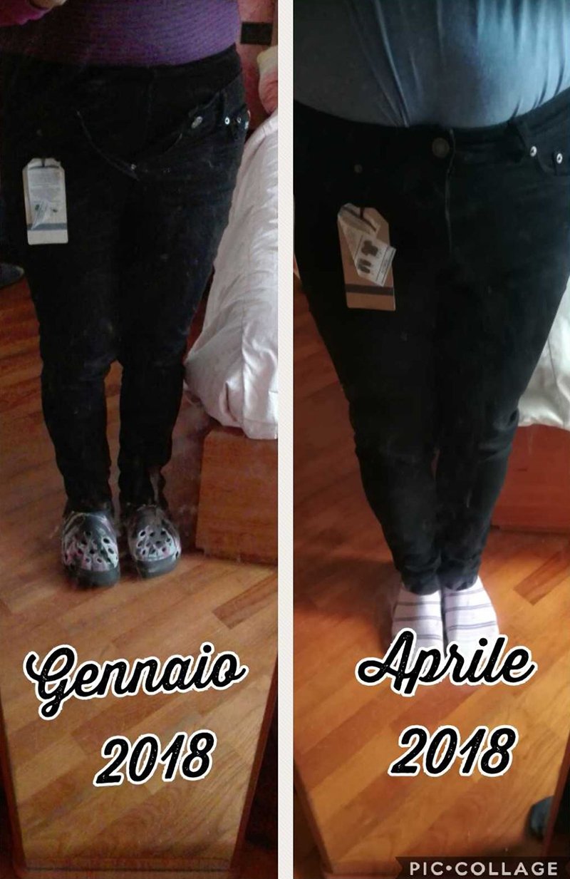 Risultato prima e dopo di Chiara