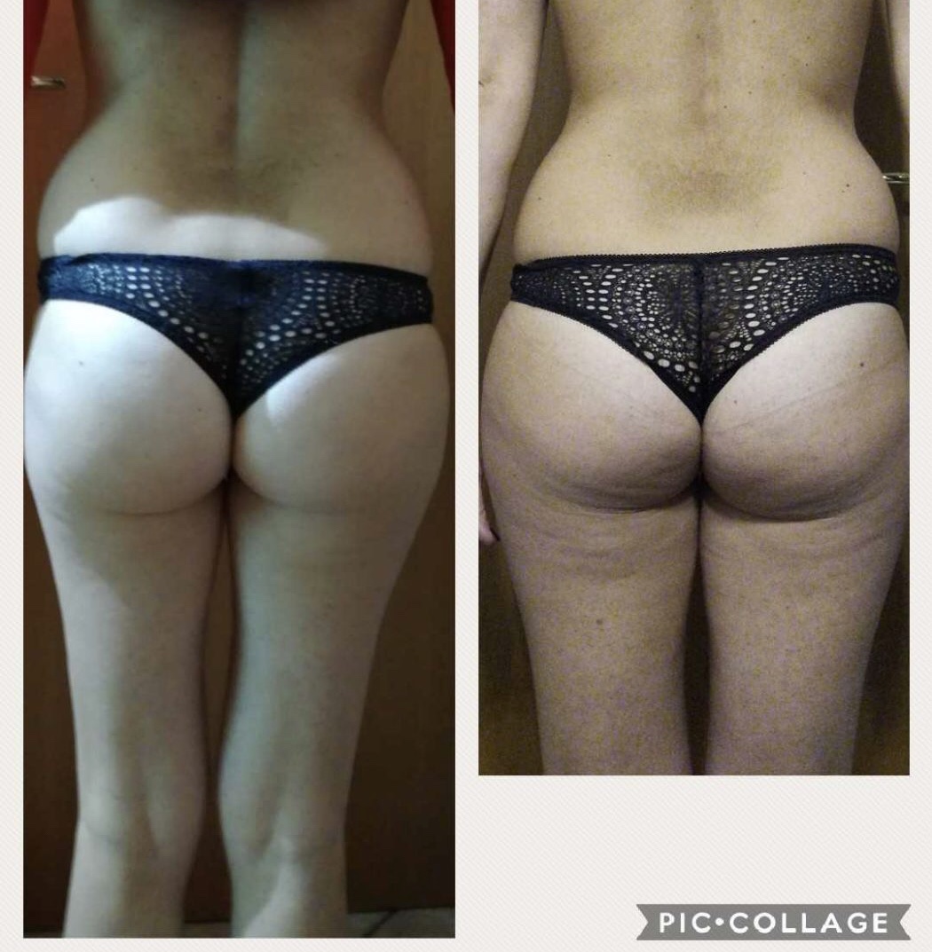Risultato prima e dopo di Monica