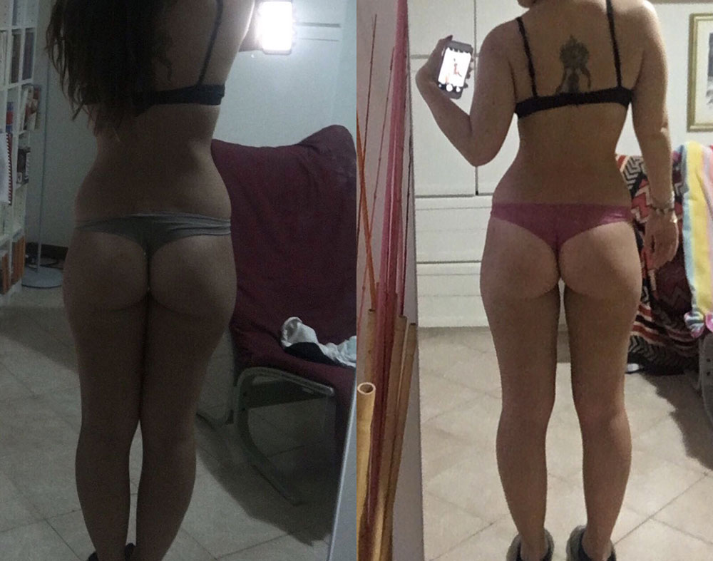 Risultato prima e dopo di Martina